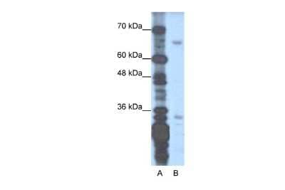 Western Blot: ZNF691 Antibody [NBP2-83895]