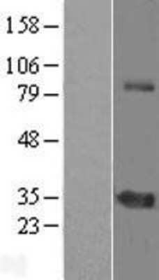 Western Blot: ZNF691 Overexpression Lysate [NBL1-18230]