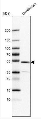 Western Blot: ZNF692 Antibody [NBP2-37973]