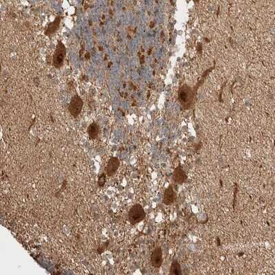 Immunohistochemistry-Paraffin: ZNF695 Antibody [NBP1-80783]