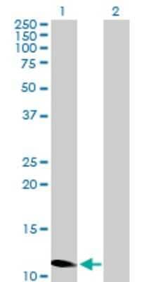 Western Blot: ZNF695 Antibody [H00057116-B01P]