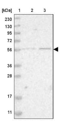 Western Blot: ZNF695 Antibody [NBP1-80783]