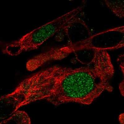 Immunocytochemistry/ Immunofluorescence: ZNF696 Antibody [NBP2-56294]