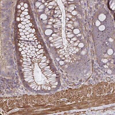 Immunohistochemistry-Paraffin: ZNF696 Antibody [NBP2-34088]