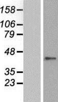 Western Blot: ZNF696 Overexpression Lysate [NBP2-06169]