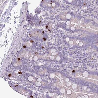 Immunohistochemistry-Paraffin: ZNF697 Antibody [NBP2-13592]