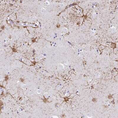 Immunohistochemistry: ZNF699 Antibody [NBP2-38848]