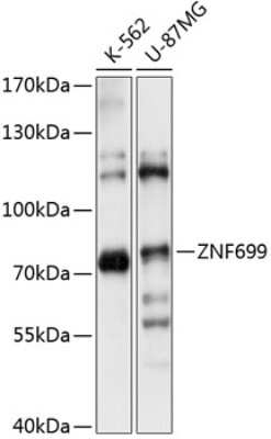 Western Blot: ZNF699 AntibodyAzide and BSA Free [NBP2-94347]