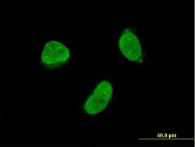 Immunocytochemistry/ Immunofluorescence: ZNF7 Antibody (6F2) [H00007553-M04]