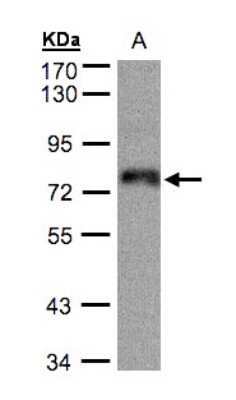 Western Blot: ZNF7 Antibody [NBP1-32386]