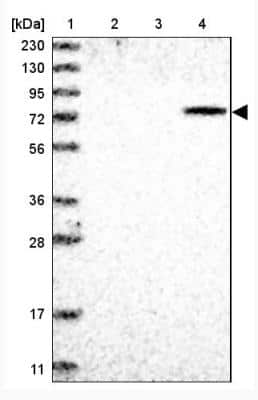 Western Blot: ZNF7 Antibody [NBP1-83264]