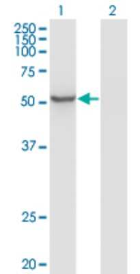 Western Blot: ZNF70 Antibody (1D8) [H00007621-M01]