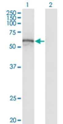 Western Blot: ZNF70 Antibody (1E3) [H00007621-M06]