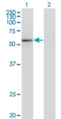 Western Blot: ZNF70 Antibody (3F8) [H00007621-M02]