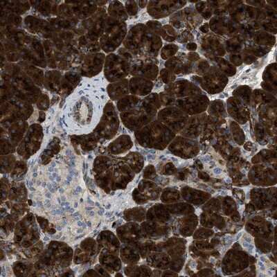 Immunohistochemistry-Paraffin: ZNF70 Antibody [NBP1-84402]