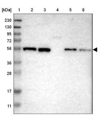 Western Blot: ZNF70 Antibody [NBP1-84402]