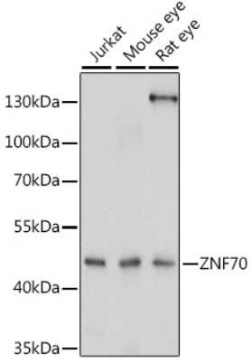 Western Blot: ZNF70 AntibodyAzide and BSA Free [NBP2-93705]