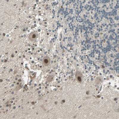 Immunohistochemistry-Paraffin: ZNF701 Antibody [NBP1-83815]