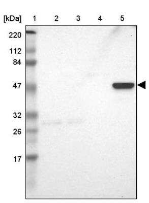 Western Blot: ZNF701 Antibody [NBP1-83815]