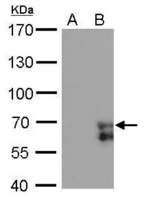 Western Blot: ZNF703 Antibody (372) [NBP2-43777]