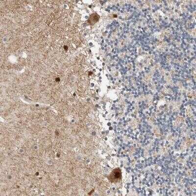 Immunohistochemistry-Paraffin: ZNF703 Antibody [NBP1-82239]
