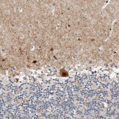Immunohistochemistry-Paraffin: ZNF703 Antibody [NBP1-82239]