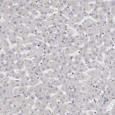 Immunohistochemistry-Paraffin: ZNF703 Antibody [NBP1-82239]