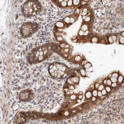 Immunohistochemistry: ZNF704 Antibody [NBP1-93999]