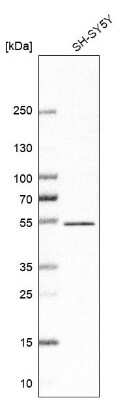 Western Blot: ZNF704 Antibody [NBP1-93998]