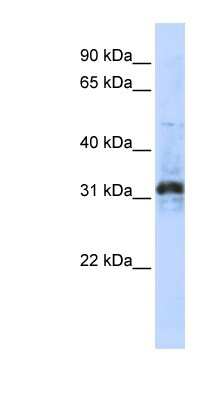 Western Blot: ZNF705D Antibody [NBP1-79367]