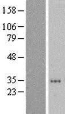 Western Blot: ZNF705D Overexpression Lysate [NBL1-12629]