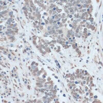 Immunohistochemistry-Paraffin: ZNF707 Antibody - BSA Free [NBP3-05075]