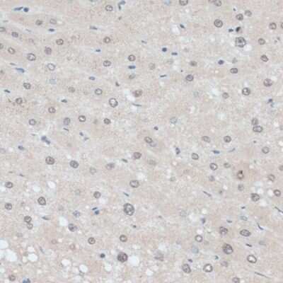 Immunohistochemistry-Paraffin: ZNF707 Antibody - BSA Free [NBP3-05075]