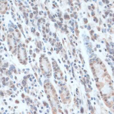 Immunohistochemistry-Paraffin: ZNF707 Antibody - BSA Free [NBP3-05075]