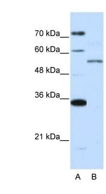 Western Blot: ZNF707 Antibody [NBP1-80430]