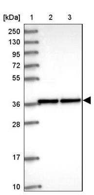 Western Blot: ZNF707 Antibody [NBP1-92642]