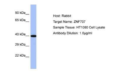 Western Blot: ZNF707 Antibody [NBP2-86551]