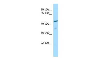 Western Blot: ZNF707 Antibody [NBP3-10517]