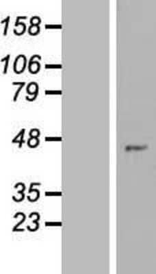 Western Blot: ZNF707 Overexpression Lysate [NBP2-09330]