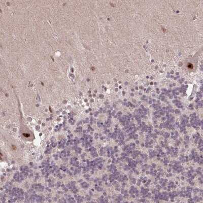 Immunohistochemistry-Paraffin: ZNF709 Antibody [NBP2-13593]