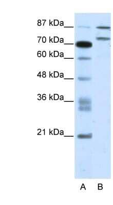 Western Blot: ZNF709 Antibody [NBP1-80164]