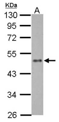 Western Blot: EZFIT/ZNF71 Antibody [NBP2-21044]