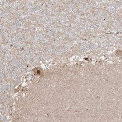 Immunohistochemistry: ZNF710 Antibody [NBP2-38156]