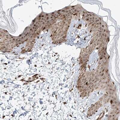 Immunohistochemistry-Paraffin: ZNF710 Antibody [NBP1-84166]