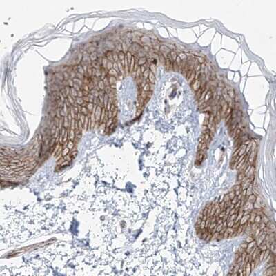 Immunohistochemistry-Paraffin: ZNF710 Antibody [NBP1-84167]