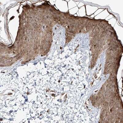 Immunohistochemistry-Paraffin: ZNF710 Antibody [NBP2-38156]