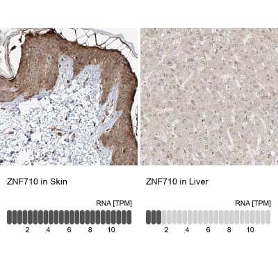 Immunohistochemistry-Paraffin: ZNF710 Antibody [NBP2-38156]