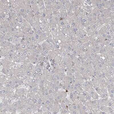 Immunohistochemistry-Paraffin: ZNF711 Antibody [NBP1-85538]