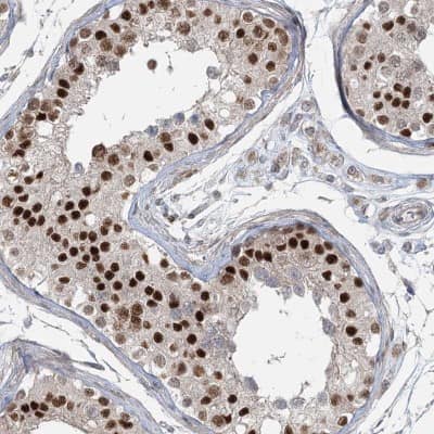 Immunohistochemistry-Paraffin: ZNF711 Antibody [NBP1-85538]