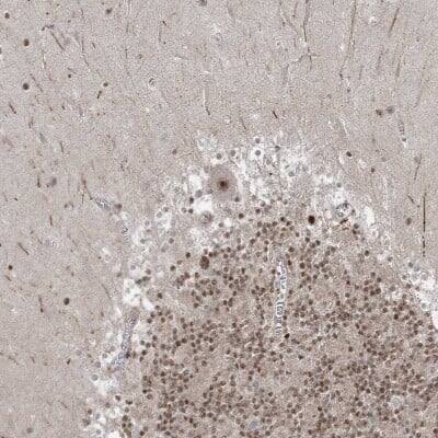 Immunohistochemistry-Paraffin: ZNF711 Antibody [NBP1-85538]